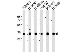 All lanes : Anti-KCNMB2 Antibody (N-term) at 1:2000 dilution Lane 1: human brain lysates Lane 2: human heart lysates Lane 3: human kidney lysates Lane 4: HepG2 whole cell lysates Lane 5: mouse brain lysates Lane 6: rat brain lysates Lysates/proteins at 20 μg per lane.