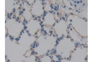 Detection of ICAM2 in Rat Lung Tissue using Polyclonal Antibody to Intercellular Adhesion Molecule 2 (ICAM2) (ICAM2 anticorps  (AA 29-247))