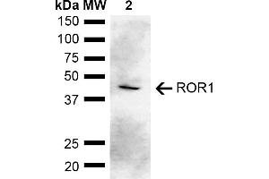 Western blot analysis of Rat Kidney showing detection of ~43 kDa ROR1 protein using Rabbit Anti-ROR1 Polyclonal Antibody (ABIN5667803).