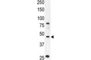 Western Blotting (WB) image for anti-Chemokine Binding Protein 2 (CCBP2) antibody (ABIN3001323)