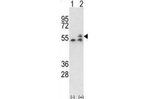Western Blotting (WB) image for anti-ATP Synthase, H+ Transporting, Mitochondrial F1 Complex, beta Polypeptide (ATP5B) antibody (ABIN3001742)