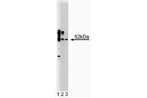 Western blot analysis of CaM Kinase II on a rat cerebrum lysate (First Panel). (CAMK2A anticorps  (AA 448-460))