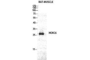 Western Blotting (WB) image for anti-Homeobox C6 (HOXC6) (C-Term) antibody (ABIN3185076)