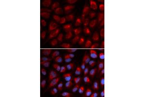 Immunofluorescence (IF) image for anti-Erythrocyte Membrane Protein Band 4.1 (Elliptocytosis 1, RH-Linked) (EPB41) antibody (ABIN1872554) (EPB41 anticorps)