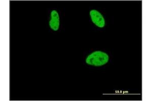 Immunofluorescence (IF) image for anti-Runt-Related Transcription Factor 2 (RUNX2) (AA 251-351) antibody (ABIN614560)