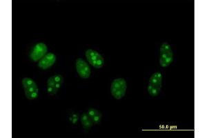 Immunofluorescence of purified MaxPab antibody to DDX54 on HeLa cell. (DDX54 anticorps  (AA 1-881))