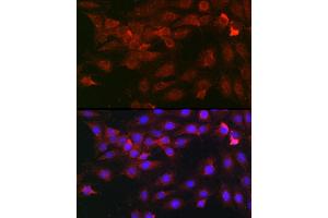 Immunofluorescence analysis of C6 cells using Heparanase 1 Rabbit pAb (ABIN6128033, ABIN6141977, ABIN6141978 and ABIN6221391) at dilution of 1:100 (40x lens). (HPSE anticorps  (AA 36-275))