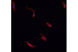 ABIN6276765 staining HepG2? (IDO1 anticorps  (Internal Region))