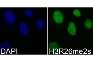 Immunofluorescence analysis of 293T cell using H3R26me2s antibody. (Histone anticorps)