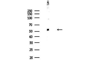 anti-Cell Division Cycle 25 Homolog C (S. Pombe) (CDC25C) (pSer216) antibody