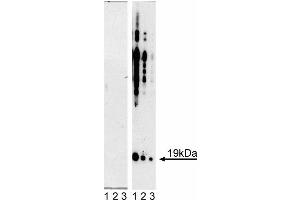 Western blot analysis of alpha-Synuclein (pY125). (SNCA anticorps  (pTyr125, Tyr125))