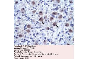 Human Brain (RNF141 anticorps  (Middle Region))