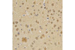 Immunohistochemistry of paraffin-embedded mouse brain using DNMT3A antibody at dilution of 1:200 (x400 lens) (DNMT3A anticorps)