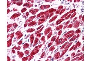 Human Spleen; EAP30 antibody - N-terminal region in Human Spleen cells using Immunohistochemistry
