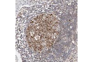 Immunohistochemical staining of human appendix with CDCA7L polyclonal antibody  shows strong nuclear positivity in lymphoid reaction center cells at 1:500-1:1000 dilution. (CDCA7L anticorps)