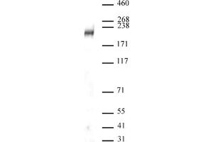 DOT1L antibody (pAb) tested by Western blot. (DOT1L anticorps  (C-Term))