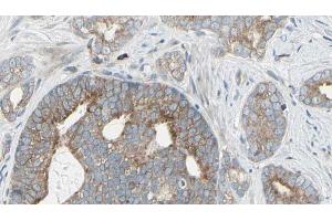 ABIN6268974 at 1/100 staining Human prostate tissue by IHC-P. (EIF4B anticorps  (pSer422))
