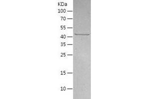 Western Blotting (WB) image for Casein Kinase 1, gamma 2 (CSNK1G2) (AA 18-415) protein (His-IF2DI Tag) (ABIN7122157)