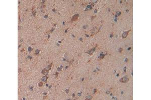 Used in DAB staining on fromalin fixed paraffin- embedded Kidney tissue