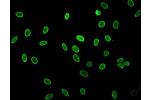 Immunofluorescent analysis of Hela cells (sodium butyrate, 30 mM, 4h) using ABIN7139162 at dilution of 1:100 and Alexa Fluor 488-congugated AffiniPure Goat Anti-Rabbit IgG(H+L)