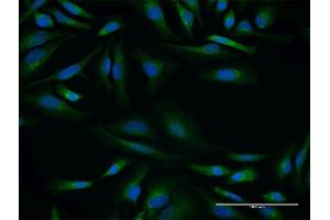 Immunofluorescence of purified MaxPab antibody to SPINT2 on HeLa cell.