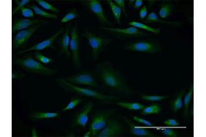 Immunofluorescence of purified MaxPab antibody to SPINT2 on HeLa cell. (SPINT2 anticorps  (AA 1-252))