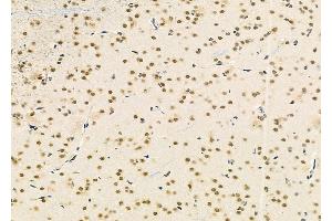 ABIN6265493 and ABIN6279878 at 1/100 staining Rat brain tissue by IHC-P. (TCEAL2 anticorps  (Internal Region))