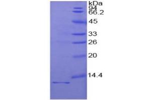 SDS-PAGE of Protein Standard from the Kit  (Highly purified E. (IL1R1 Kit ELISA)