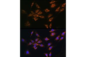 Immunofluorescence analysis of C6 cells using FGF2 Rabbit pAb (ABIN3020744, ABIN3020745, ABIN3020746 and ABIN6213702) at dilution of 1:100 (40x lens). (FGF2 anticorps  (AA 143-288))