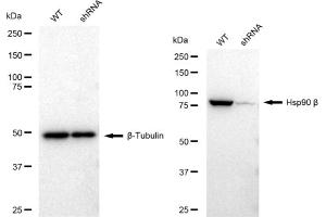 Western blotting analysis using Hsp90 beta antibody (ABIN7798872).