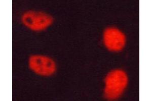 ABIN6267323 staining HT-29 cells by ICC/IF.