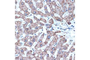 Immunohistochemistry of paraffin-embedded human liver using  Rabbit mAb (ABIN7265434) at dilution of 1:100 (40x lens).