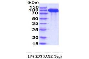 SDS-PAGE (SDS) image for Platelet Derived Growth Factor Receptor beta (PDGFRB) (AA 33-532) protein (hIgG-His-tag) (ABIN5855064)