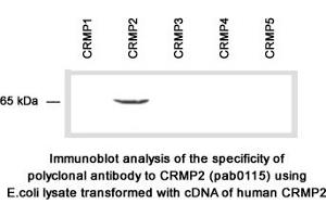 Image no. 2 for anti-Collapsing-Response Mediator Protein 2 (CRMP-2) (C-Term) antibody (ABIN347038) (Collapsing-Response Mediator Protein 2 (CRMP-2) (C-Term) anticorps)