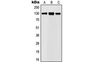 Western blot analysis of JAK1 (pY1022) expression in Ramos (A), Jurkat (B), L929 (C), PC12 (D) whole cell lysates. (JAK1 anticorps  (C-Term, pTyr1022))
