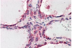 Human Thyroid (formalin-fixed, paraffin-embedded) stained with WNT3 antibody ABIN461935 at 3. (WNT3 anticorps  (AA 315-329))
