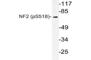 Western blot (WB) analyzes of p-NF2 antibody in extracts from Jurkat IFN cells. (Merlin anticorps  (pSer518))