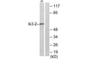 Western blot analysis of extracts from Jurkat cells, using Ik3-2 antibody. (CABLES2 anticorps)