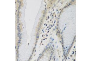 Immunohistochemistry of paraffin-embedded human stomach using CCL26 antibody at dilution of 1:200 (40x lens). (CCL26 anticorps)