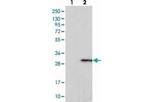 Western blot analysis of Lane 1: Negative control (vector only transfected HEK293T lysate), Lane 2: Over-expression Lysate (Co-expressed with a C-terminal myc-DDK tag (~3. (C1ORF109 anticorps)