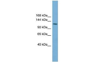 WB Suggested Anti-CDC27  Antibody Titration: 0. (CDC27 anticorps  (Middle Region))