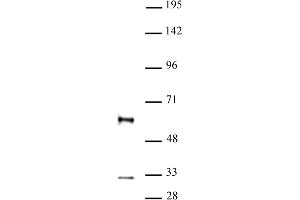 GFI1 antibody (pAb) tested by Western blot. (GFI1 anticorps  (N-Term))