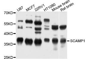 Western blot analysis of extract of various cells, using SCAMP1 antibody. (SCAMP1 anticorps)