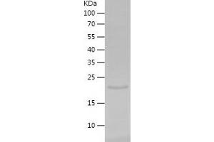 Western Blotting (WB) image for Egf-Like Module Containing, Mucin-Like, Hormone Receptor-Like 1 (EMR1) (AA 376-506) protein (His-IF2DI Tag) (ABIN7122745)