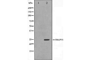 Western blot analysis on RAW264. (SNAP25 anticorps  (C-Term))