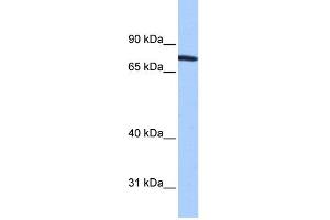 WB Suggested Anti-ZNF45 Antibody Titration:  0.