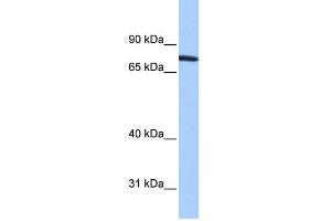 WB Suggested Anti-ZNF45 Antibody Titration:  0. (ZNF45 anticorps  (N-Term))