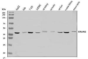 Western blot analysis of Erlin-2/ERLIN2 using anti-Erlin-2/ERLIN2 antibody (ABIN7602583).