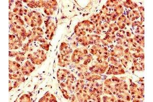 Immunohistochemistry of paraffin-embedded human pancreatic tissue using ABIN7164097 at dilution of 1:100 (PRDM4 anticorps  (AA 301-500))