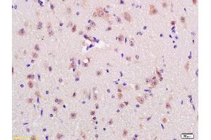 Formalin-fixed and paraffin embedded rat brain labeled with Anti-RNF123 Polyclonal Antibody, Unconjugated  at 1:200 followed by conjugation to the secondary antibody and DAB staining (RNF123 anticorps  (AA 2-52))